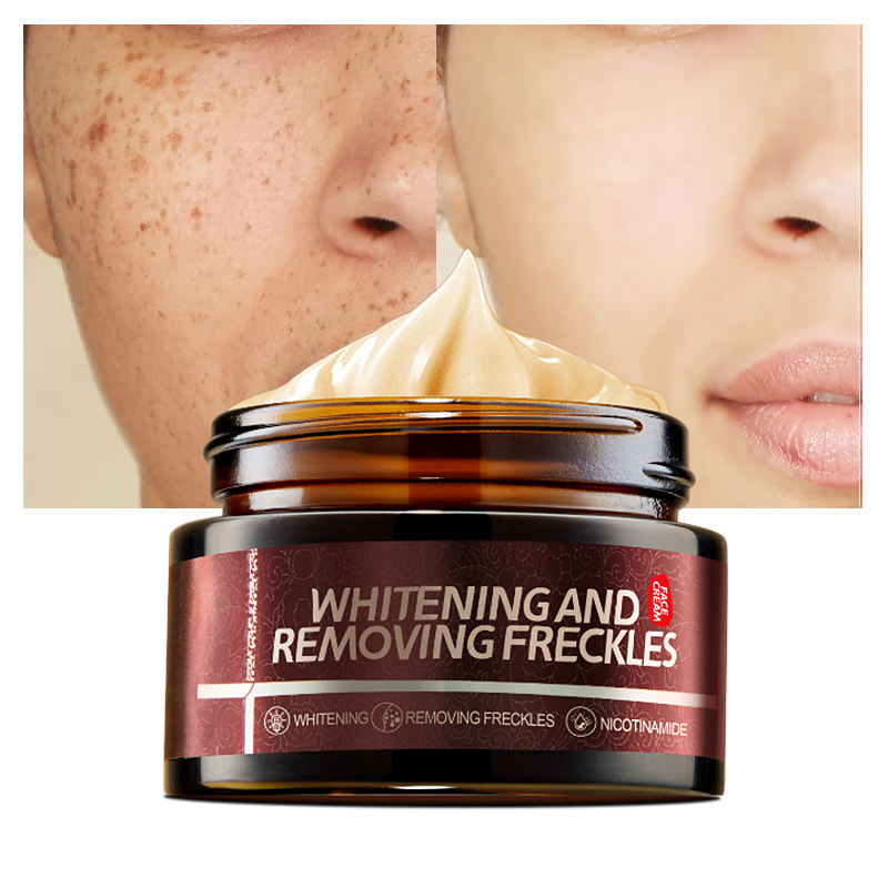 Cremă pentru Pete Pigmentare cu Acid Hialuronic și Niacinamidă